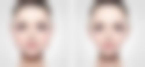 血压高能做眼袋手术吗之术后护理