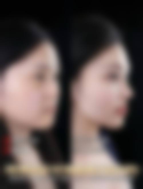 南宁英美整形医院价格表