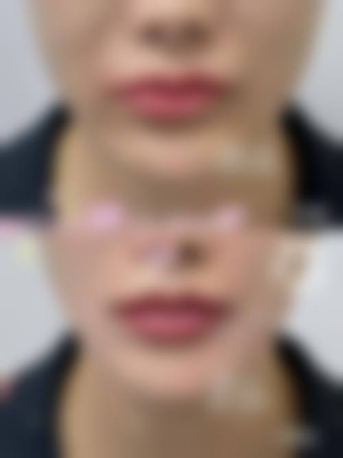 陈子益医生顾客实例图片情况