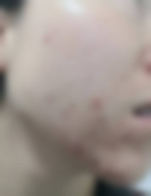 南宁英美整形医院项目特色