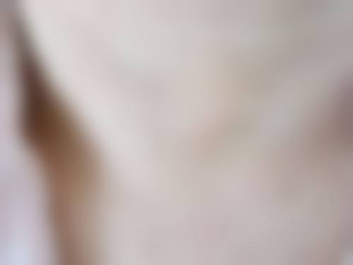 割双眼皮开眼角增生多久可以修复——浙江大学医学校附属第二医院