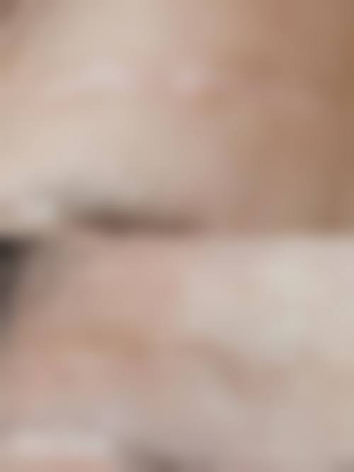 长了疤痕疙瘩怎么办？了解北京疤康的疤痕疙瘩治疗技术