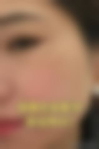 杭州任你美医疗美容诊所价格表