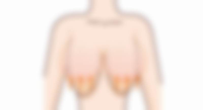 曾江华医生做手术价格:因手术而异