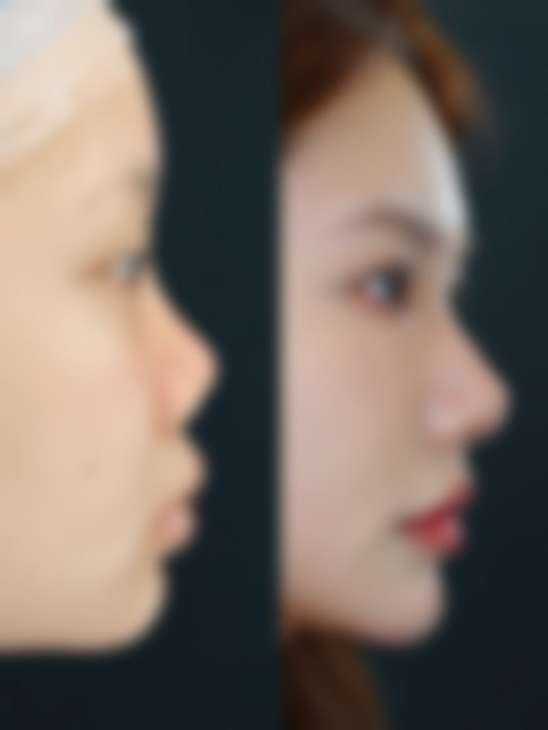 刘懿婵医生顾客实例图片