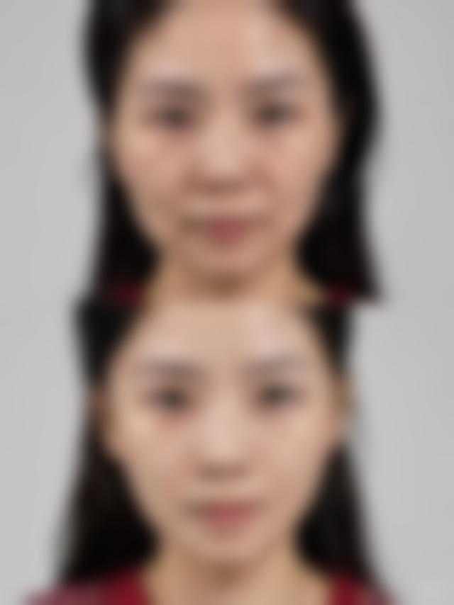 南宁英美整形医院怎么样，口碑评价如何？