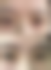 做了双眼皮以后眼皮会松弛吗——成都美辰星耀