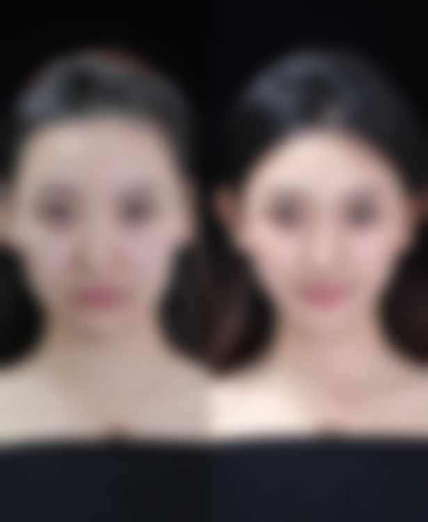 智慧抗衰,让美丽更从容