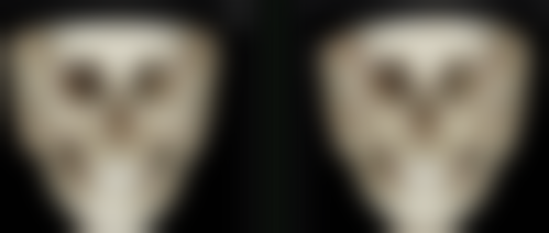 做双眼皮有必要提肌吗:常见误区大揭秘