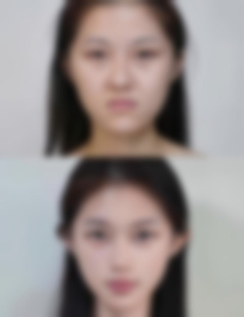 抓伤的伤疤痕迹怎么消除之祛疤膏选购指南：2025年TOP5推荐