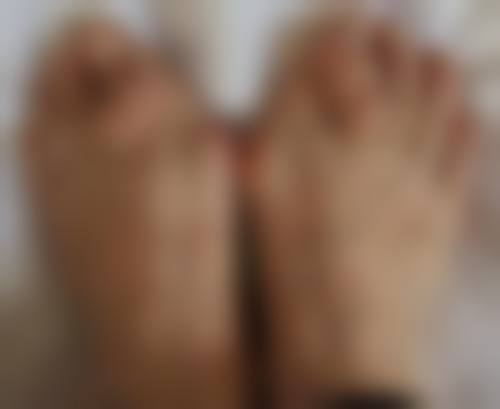 疤痕疙瘩日常护理小贴士