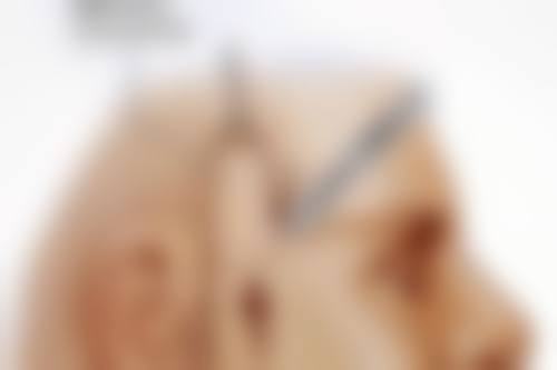 鼻综合整形修复期：3 - 6个月的漫长等待