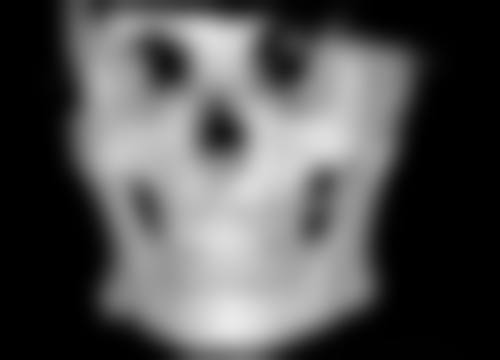 过敏体质者吃花生：警惕美丽背后的风险