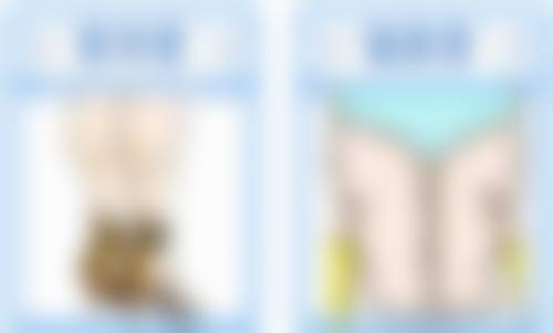 中医医院如何改善疤痕增生：内外兼修的古老智慧