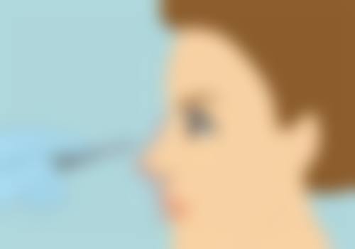 术后修复全攻略——让成效更持久