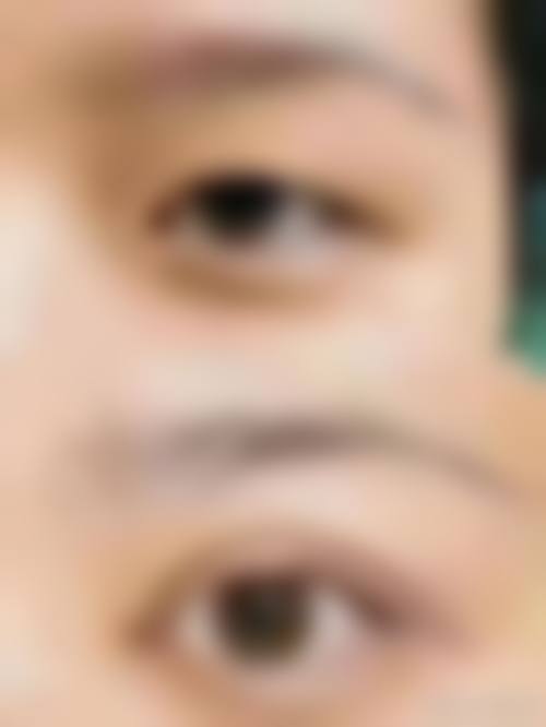 张贺明医生简介做手术价格