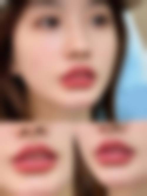 苍南灵溪欧亚医疗美容门诊部价格表