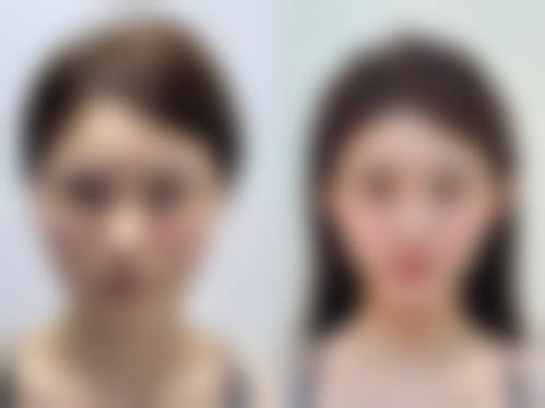 八、南京秦淮新颜整形医院价格表