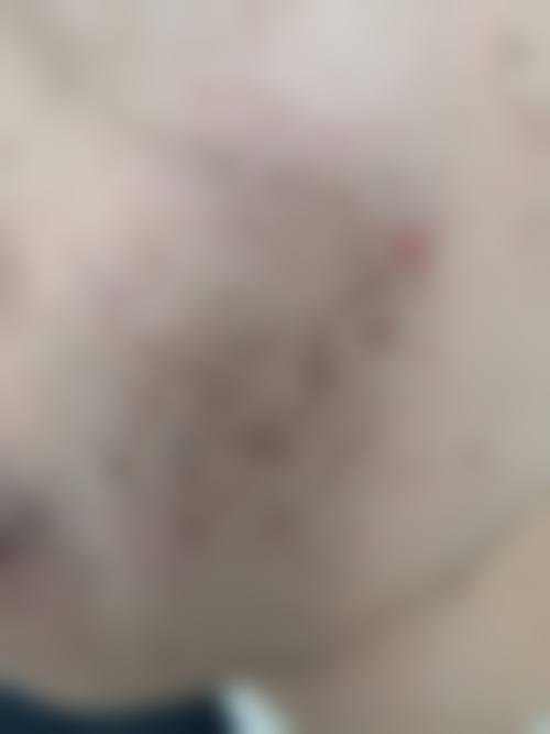 义乌连天美整形医院价格表