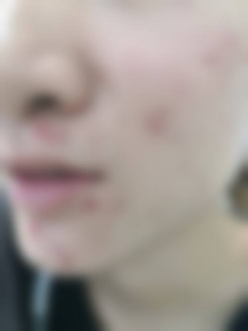 郇京宁医生简介项目优势