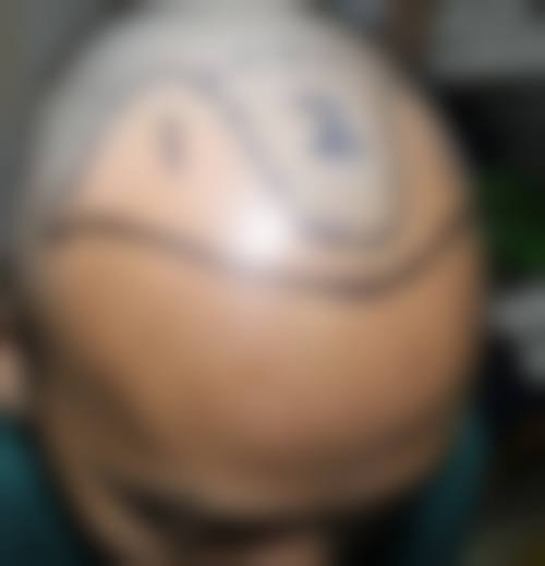 三亚三仁医疗美容门诊部价格表