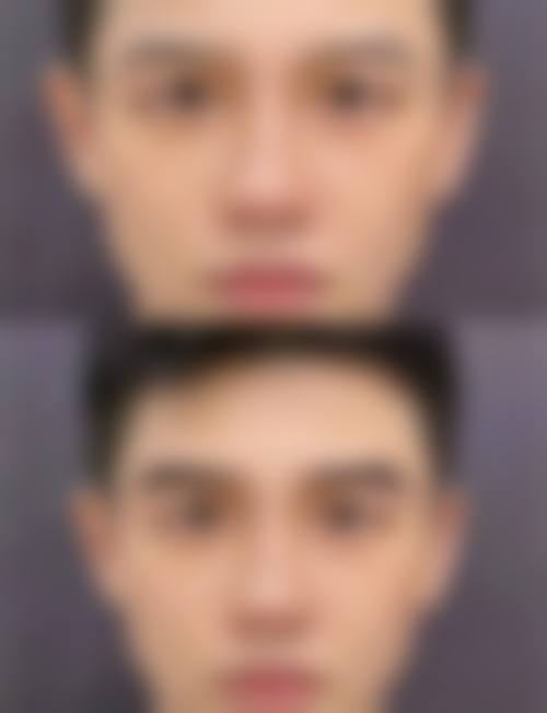 重庆华肤皮肤病医院口碑评价如何