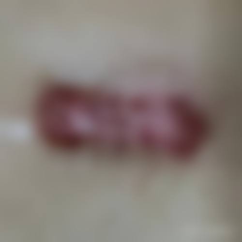 20年的疤痕怎么消除——西安莲湖西交医院