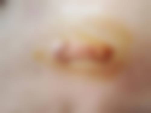 重庆华肤皮肤病医院价格表