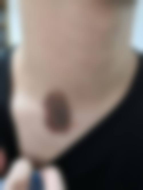 鞍山张玉霞星范医疗美容门诊部怎么样，顾客实例分享