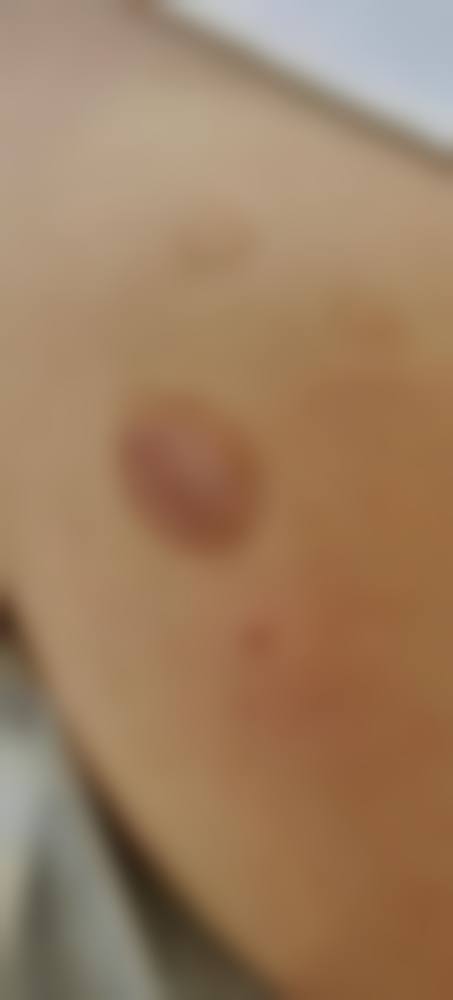 宁波市中医院(医疗美容)口碑好不好？附真实患者口碑评价