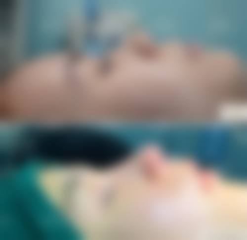 张贺明医生简介口碑如何