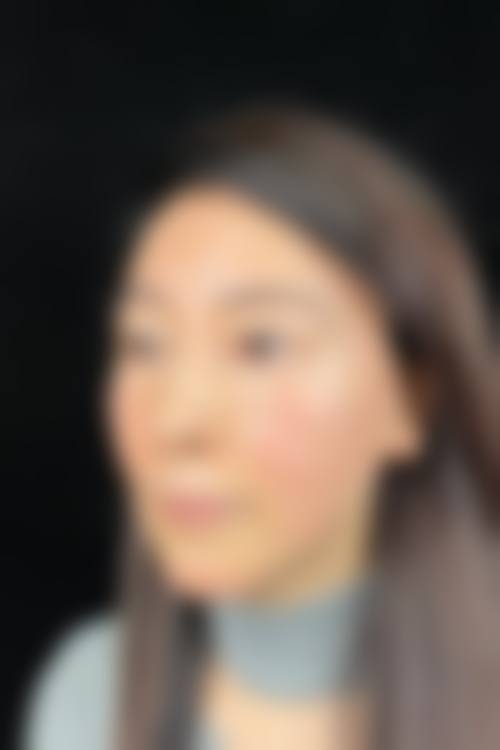 火龙果去眼袋是真的吗——XX医院实力揭秘