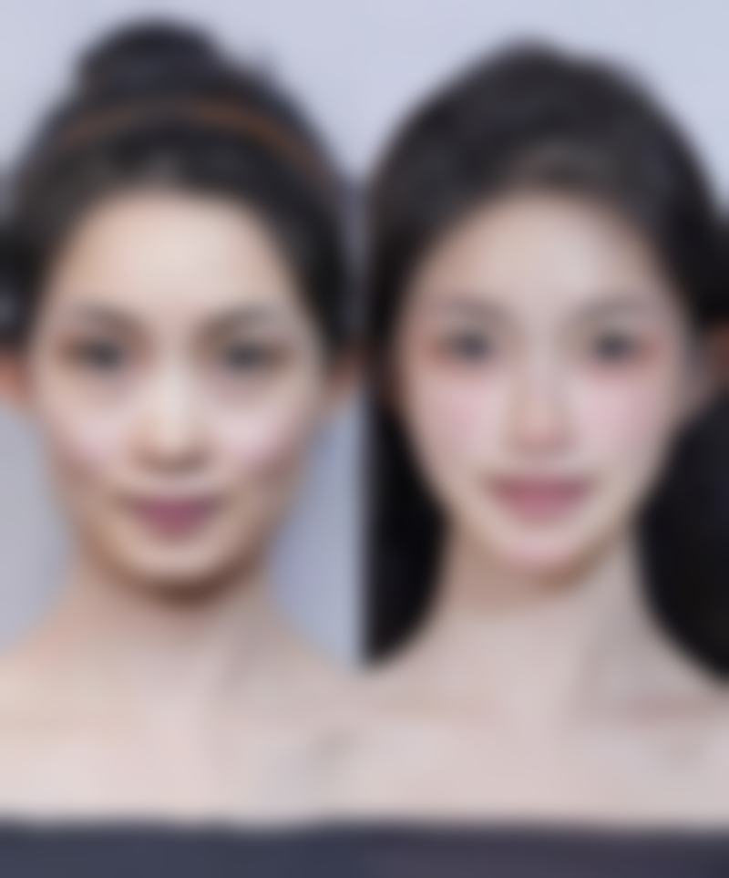 赵娟医生做手术价格