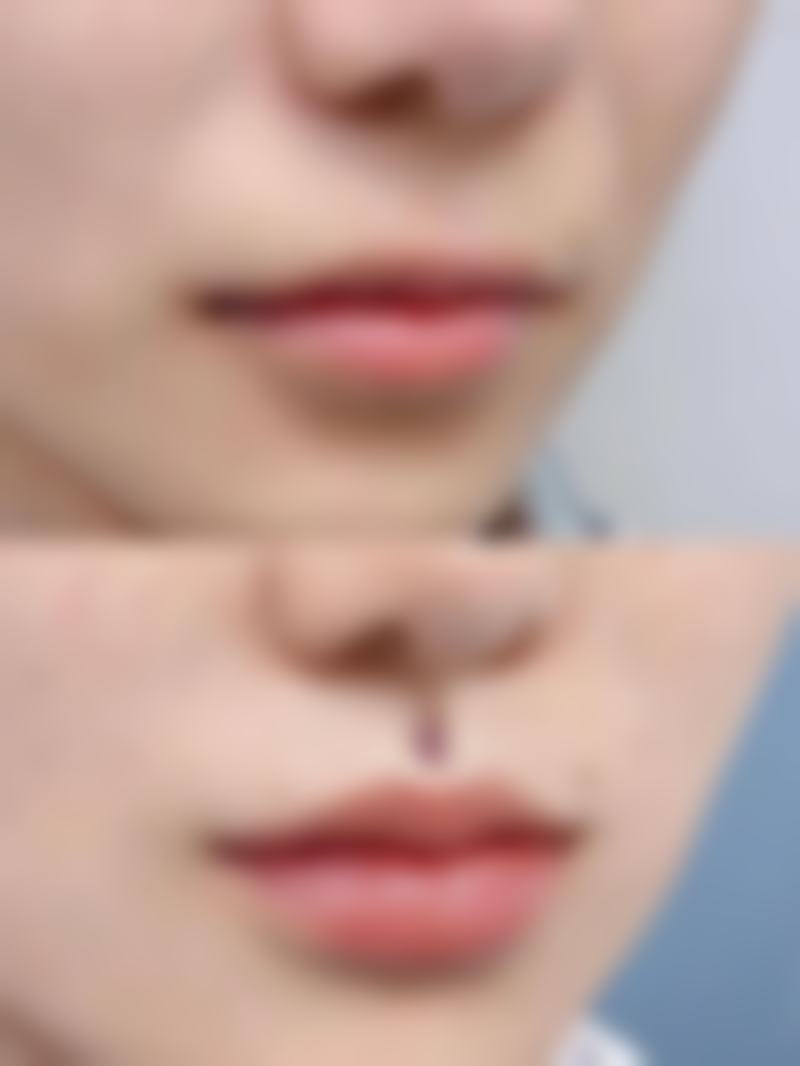 君悦医疗美容——老牌医美精细按摩消眼袋