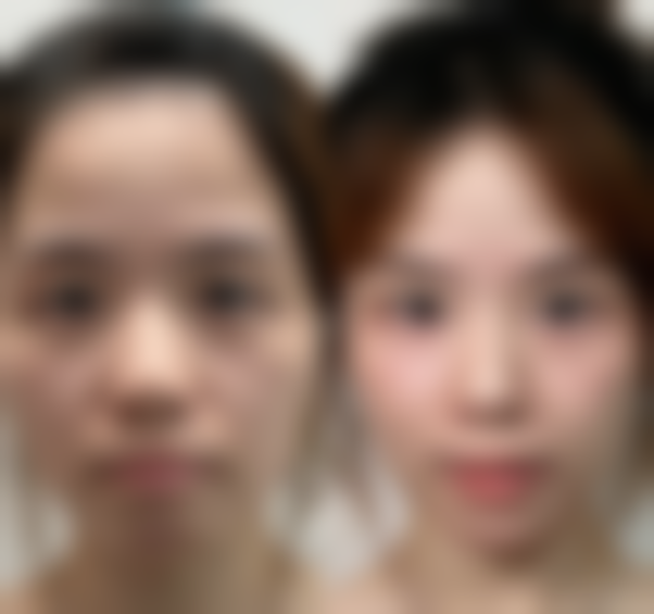 赵娟医生顾客实例图片