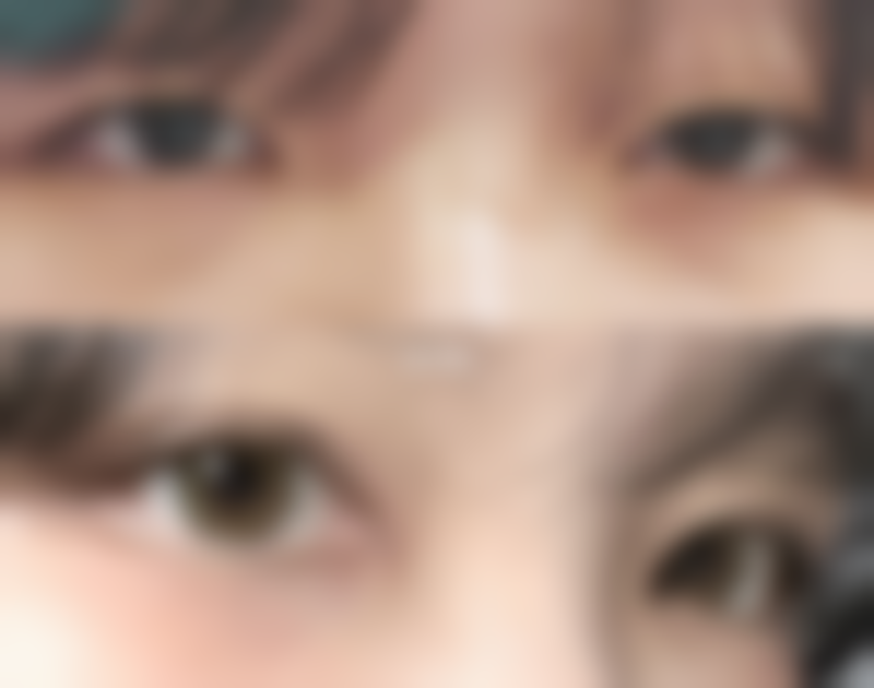 薛媚医生项目优势