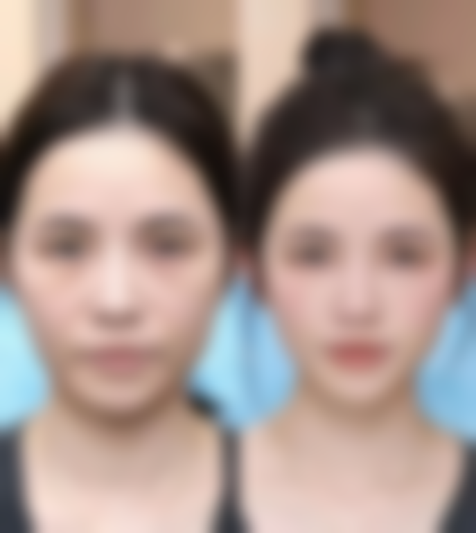 广州壹加壹医疗美容——注重术后护理的VIP男士专属去眼袋