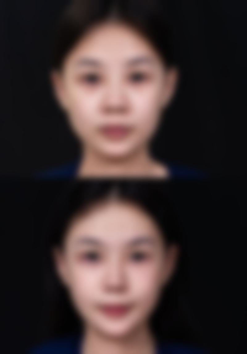 林柱焕医生怎么挂号