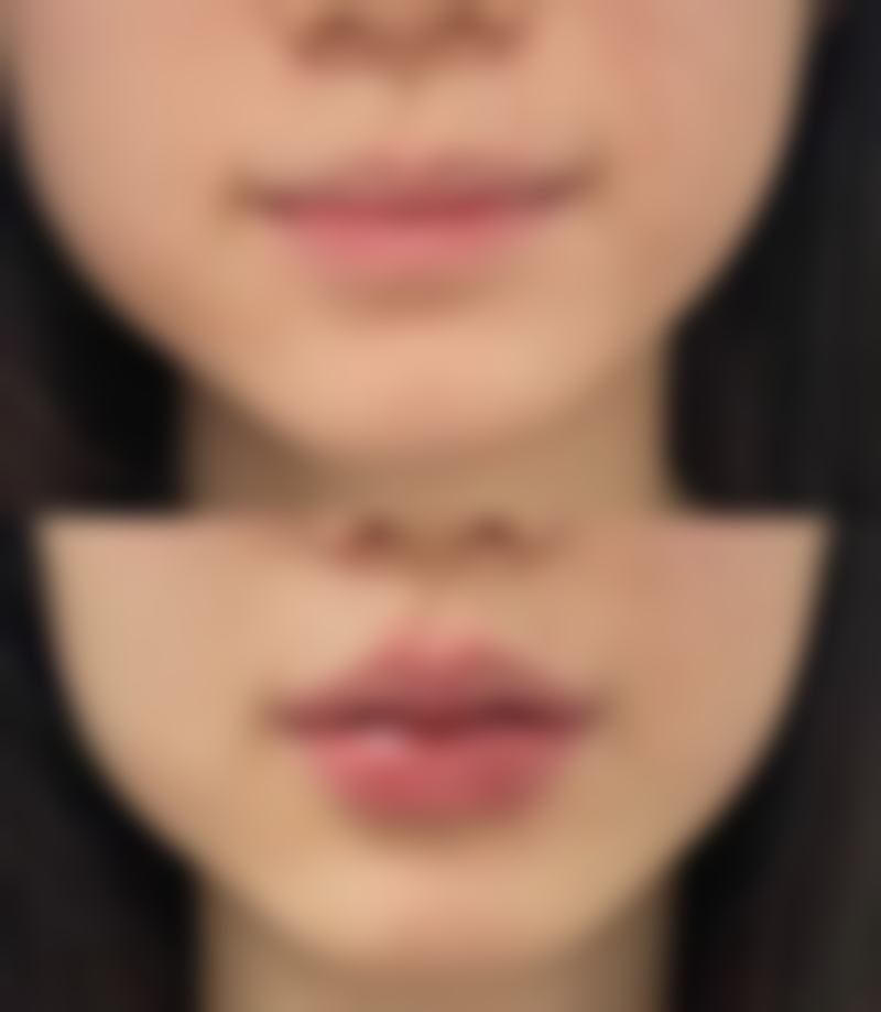 早上起来眼睛浮肿眼袋大，茶包拯救海内外的秘诀是什么