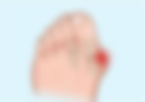 三、50岁的女人隆胸风险为何，又该如何规避