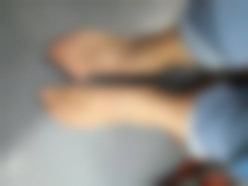 加速抽脂消肿的小妙招