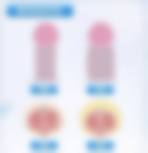 白晋医生简介做手术价格