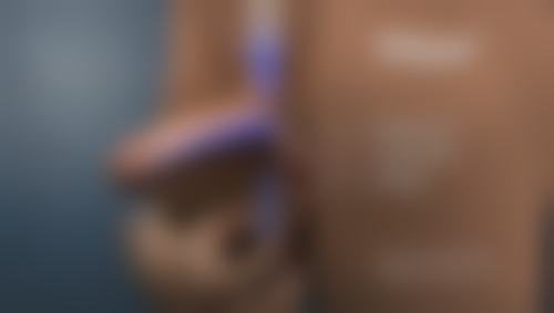 徐炜医生简介做手术价格