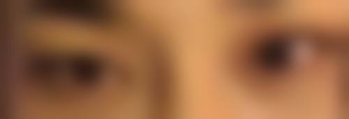 疤痕一直痒与体质有关吗