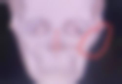 面部锻炼重塑紧致：医院认可的肌肉焕能秘法