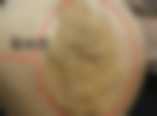 压的双眼皮太宽改窄的必知事项