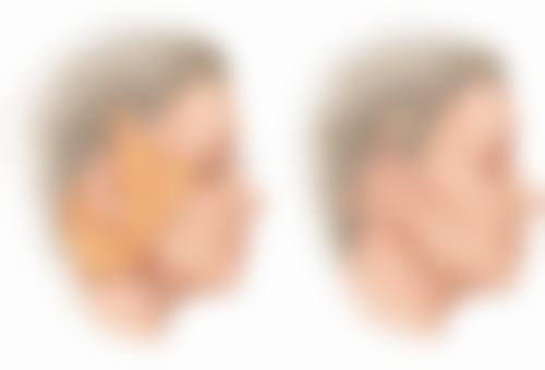 去眼袋更好更有效的食疗：内调外养双管齐下