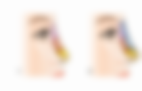 疤痕一直痒是在愈合吗