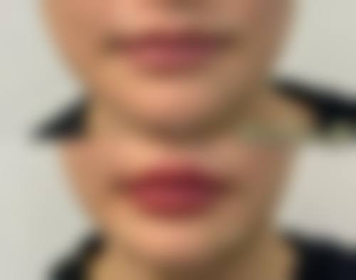 石砚安医生做手术价格