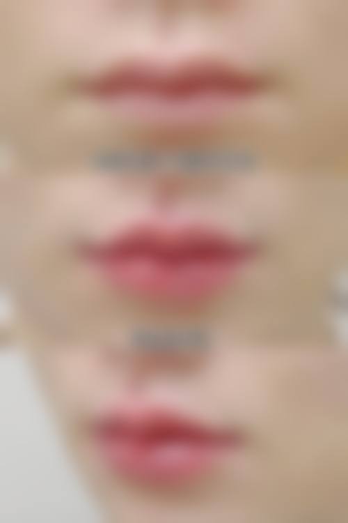 无锡朵美医疗美容门诊部顾客实例